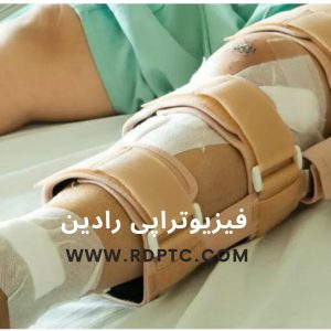 شایع ترین جراحی های زانو